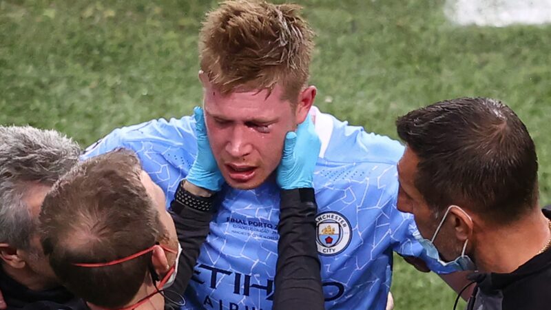 De Bruyne fratura nariz e órbita ocular