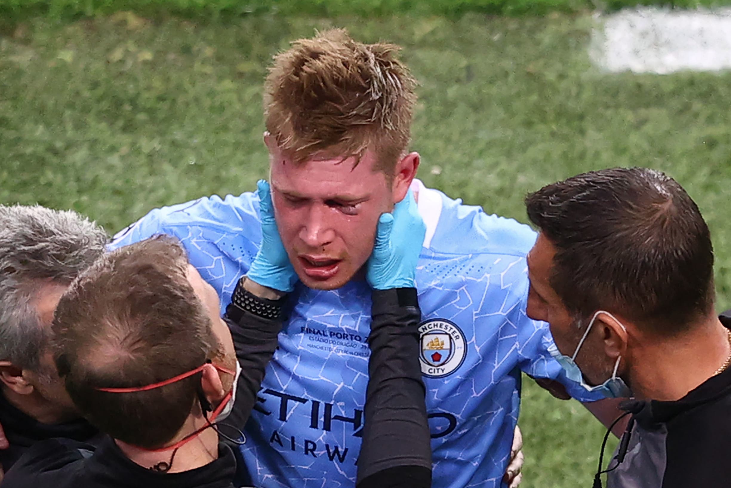 De Bruyne fratura nariz e órbita ocular